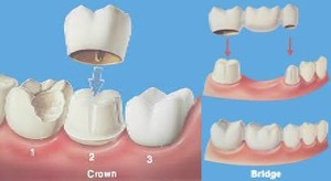 dental4 (3)